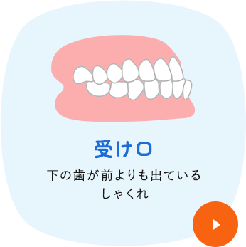 受け口