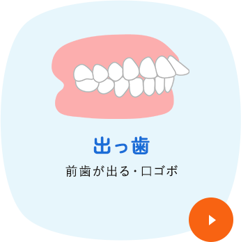 出っ歯