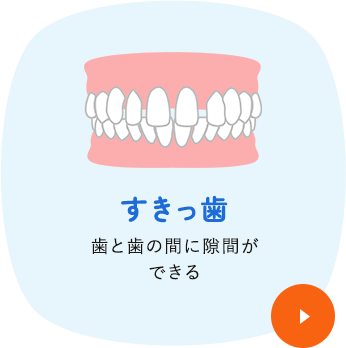 すきっ歯