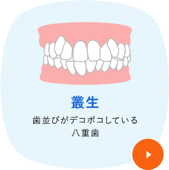 叢生