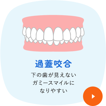 過蓋咬合