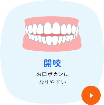開咬