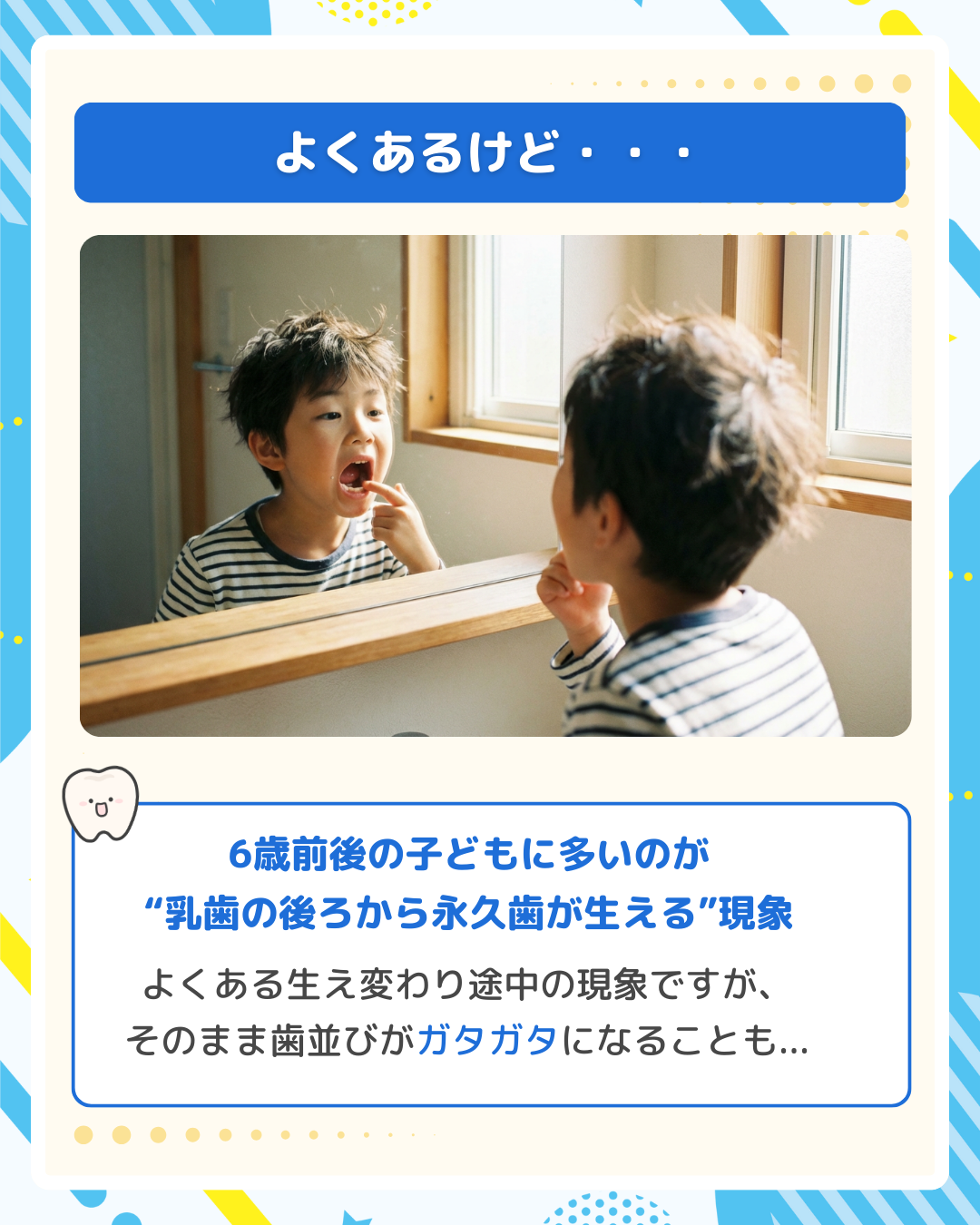 鏡で自分の歯並びをチェックする6歳の男の子｜乳歯の生え変わり時期