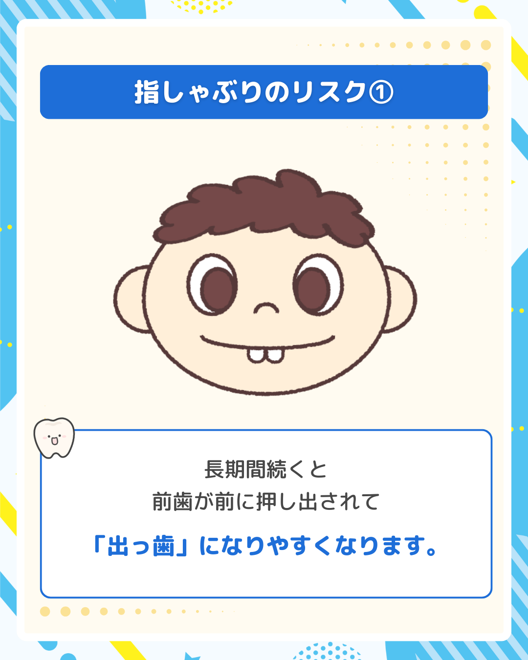 指しゃぶりによる出っ歯（上顎前突）のイラスト