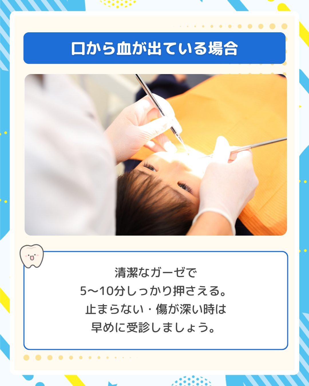 歯科医師が子どもの口を診察している写真