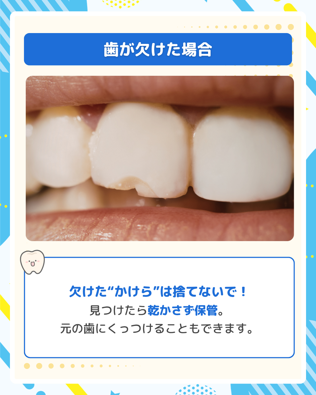 欠けた前歯のアップ